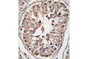 Formalin-fixed and paraffin-embedded human testis tissue reacted with TBK-p, which was peroxidase-conjugated to the secondary antibody, followed by DAB staining. (TBK1 Antikörper  (AA 150-181))