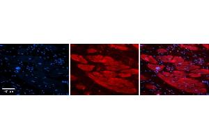 Rabbit Anti-ENO3 Antibody    Formalin Fixed Paraffin Embedded Tissue: Human Adult heart  Observed Staining: Cytoplasmic Primary Antibody Concentration: 1:100 Secondary Antibody: Donkey anti-Rabbit-Cy2/3 Secondary Antibody Concentration: 1:200 Magnification: 20X Exposure Time: 0. (ENO3 Antikörper  (N-Term))