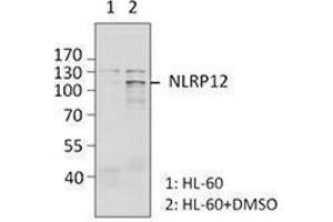 Western Blotting (WB) image for anti-NLR Family, Pyrin Domain Containing 12 (NLRP12) antibody (ABIN2665297) (NLRP12 Antikörper)