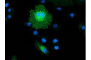 Anti-MAPRE2 mouse monoclonal antibody (ABIN2454619) immunofluorescent staining of COS7 cells transiently transfected by pCMV6-ENTRY MAPRE2 (RC200259). (MAPRE2 Antikörper)