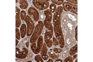 Immunohistochemical staining of human kidney with EXOC3L1 polyclonal antibody  shows strong cytoplasmic positivity in cells in tubules at 1:200-1:500 dilution. (EXOC3L1 Antikörper)