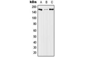 Western blot analysis of EGFR (pT678) expression in A431 EGF-treated (A), NIH3T3 EGF-treated (B), PC12 EGF-treated (C) whole cell lysates. (EGFR Antikörper  (pSer678))