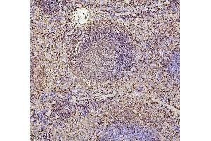 IHC analysis of PAX5 using anti-PAX5 antibody (ABIN7600655).