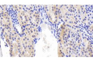 Detection of BMP6 in Human Kidney Tissue using Polyclonal Antibody to Bone Morphogenetic Protein 6 (BMP6) (BMP6 Antikörper  (AA 375-513))