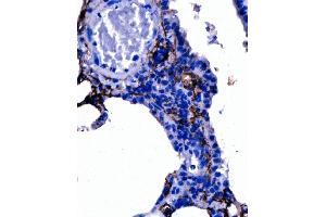 IHC analysis of Podoplanin/gp36/Pdpn using anti-Podoplanin/gp36/Pdpn antibody (ABIN7600811).