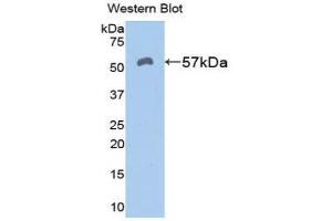 Western Blotting (WB) image for anti-Aldehyde Dehydrogenase 7 Family, Member A1 (ALDH7A1) (AA 29-539) antibody (ABIN1077760) (ALDH7A1 Antikörper  (AA 29-539))