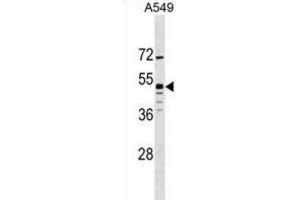 Western Blotting (WB) image for anti-G Protein-Coupled Receptor 83 (GPR83) antibody (ABIN3000043) (GPR83 Antikörper)