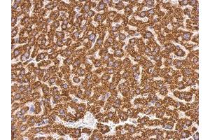 IHC-P Image ABAT antibody detects ABAT protein at mitochondria on mouse liver by immunohistochemical analysis. (ABAT Antikörper)