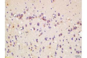 Immunohistochemistry (Paraffin-embedded Sections) (IHC (p)) image for anti-Wingless-Type MMTV Integration Site Family, Member 8B (WNT8B) (AA 131-230) antibody (ABIN716306)