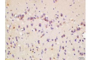 Formalin-fixed and paraffin embedded rat brain labeled with Rabbit Anti-Wnt8b Polyclonal Antibody, Unconjugated  at 1:200 followed by conjugation to the secondary antibody and DAB staining