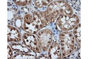 Immunohistochemical staining of paraffin-embedded liver tissue using anti-HDAC10 mouse monoclonal antibody. (HDAC10 Antikörper)