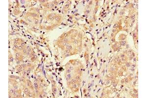 Immunohistochemistry (IHC) image for anti-Cyclin-Dependent Kinase Inhibitor 2B (p15, Inhibits CDK4) (CDKN2B) (AA 1-138) antibody (ABIN7148885)