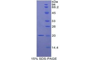 SDS-PAGE analysis of Rat Interleukin 17B Protein. (IL17B Protein)