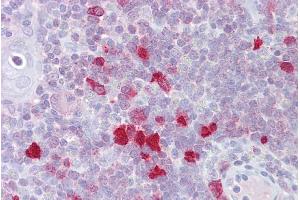 Immunohistochemistry with Thymus tissue at an antibody concentration of 5µg/ml using anti-DLX5 antibody (ARP31607_P050) (DLX5 Antikörper  (N-Term))