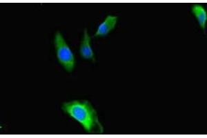 Immunofluorescent analysis of Hela cells using ABIN7171622 at dilution of 1:100 and Alexa Fluor 488-congugated AffiniPure Goat Anti-Rabbit IgG(H+L) (TBC1D24 Antikörper  (AA 1-169))