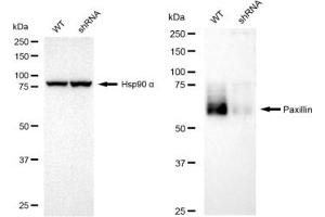 Western blotting analysis using Paxillin antibody (ABIN7799744). (Rekombinanter Paxillin Antikörper)