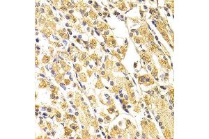 Immunohistochemistry (IHC) image for anti-Caspase 3 (CASP3) (AA 55-160) antibody (ABIN3023067)