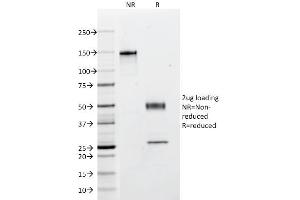 SDS-PAGE Analysis Purified Multi Cytokeratin Mouse Monoclonal Antibody (C11). (KRT4, KRT5, KRT6, KRT8, KRT10, KRT13, KRT18 Antikörper)