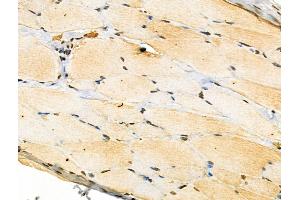 Phospho-Ephrin B1/B2/B3 (Tyr324) Antibody at 1/100 staining Rat skin tissue by IHC-P. (Ephrin B1/B2/B3 (EFNB1/2/3) (pTyr324) Antikörper)