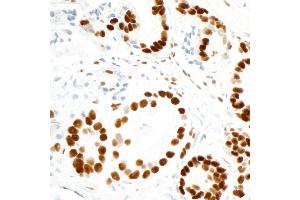 Immunohistochemistry (IHC) image for anti-Fused in Sarcoma (FUS) (AA 1-50) antibody (ABIN7454040) (Rekombinanter FUS Antikörper  (AA 1-50))