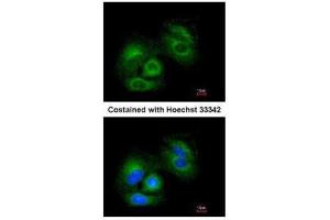 ICC/IF Image Immunofluorescence analysis of methanol-fixed A549, using SIRT3, antibody at 1:200 dilution. (SIRT3 Antikörper  (C-Term))