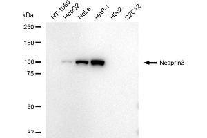 Western blotting analysis using Nesprin3 antibody (ABIN7798075).