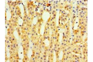 Immunohistochemistry of paraffin-embedded human adrenal gland tissue using ABIN7142344 at dilution of 1:100 (MRPL1 Antikörper  (AA 51-324))
