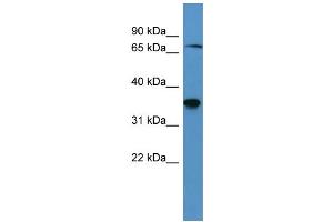 Western Blotting (WB) image for anti-SH3-Domain Binding Protein 5 (SH3BP5) (C-Term) antibody (ABIN2788422) (SH3BP5 Antikörper  (C-Term))