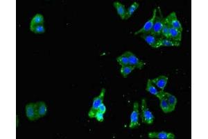 Immunofluorescent analysis of HepG2 cells using ABIN7167639 at dilution of 1:100 and Alexa Fluor 488-congugated AffiniPure Goat Anti-Rabbit IgG(H+L) (RENT1/UPF1 Antikörper  (AA 956-1125))