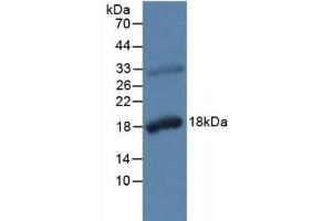 Detection of KLK2 in Rat Prostate Gland Tissue using Polyclonal Antibody to Kallikrein 2 (KLK2) (Kallikrein 2 Antikörper  (AA 19-261))