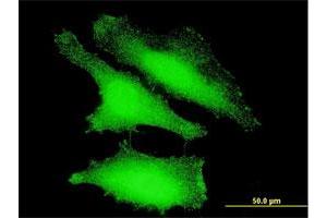 Immunofluorescence of monoclonal antibody to FOXO1 on HeLa cell. (FOXO1 Antikörper  (AA 556-655))