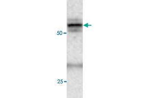Western blot under reducing conditions on rat liver lysate using rabbit ATG4C polyclonal antibody  at a dilution of 1 : 100. (ATG4C Antikörper  (C-Term))