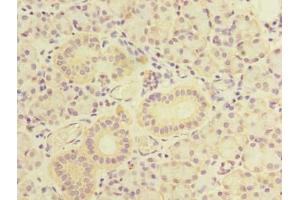 Immunohistochemistry of paraffin-embedded human pancreatic tissue using ABIN7171662 at dilution of 1:100 (TBC1D9B Antikörper  (AA 724-1023))