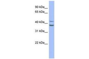 Image no. 1 for anti-Plasminogen Activator Inhibitor 2 (SERPINB2) (AA 179-228) antibody (ABIN6744064) (SERPINB2 Antikörper  (AA 179-228))