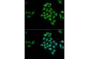 Immunofluorescence analysis of MCF7 cells using KLK10 antibody (ABIN6142943).