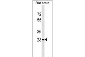 Western blot analysis in rat brain tissue lysates (35ug/lane). (HOXD9 Antikörper  (AA 127-154))