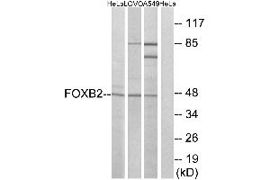 Western blot analysis of extracts from HeLa cells, LOVO cells and A549 cells, using FOXB2 antibody. (FOXB2 Antikörper  (Internal Region))