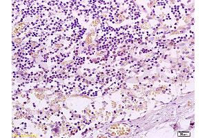 Immunohistochemistry (IHC) image for anti-Nuclear Receptor Subfamily 1, Group I, Member 2 (NR1I2) (AA 101-150) antibody (ABIN738816)