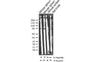 Western blot analysis of Phospho-Merlin (Ser518) expression in various lysates (Merlin Antikörper  (pSer518))