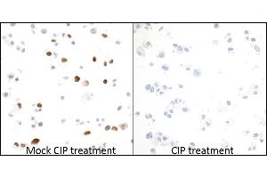 Immunocytochemistry (ICC) image for anti-Minichromosome Maintenance Complex Component 2 (MCM2) (pSer53) antibody (ABIN7449430) (Rekombinanter MCM2 Antikörper  (pSer53))