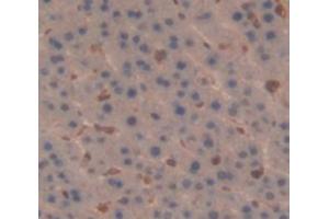 IHC-P analysis of Rat Tissue, with DAB staining. (IL-6 Receptor Antikörper  (AA 19-108))