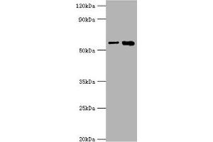 Western blot All lanes: IL1R1 antibody at 6 μg/mL Lane 1: Hela whole cell lysate Lane 2: Mouse heart tissue Secondary Goat polyclonal to rabbit IgG at 1/10000 dilution Predicted band size: 65 kDa Observed band size: 65 kDa (IL1R1 Antikörper  (AA 18-320))