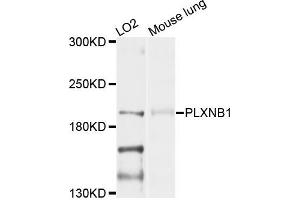 Western blot analysis of extracts of LO2 and mouse lung cells, using PLXNB1 antibody. (PLXNB1 Antikörper)