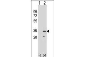 Western blot analysis of R (arrow) using rabbit polyclonal R Antibody (N-term) (ABIN653060 and ABIN2842661). (RPA2 Antikörper  (N-Term))