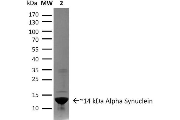 SNCA Protein (full length)