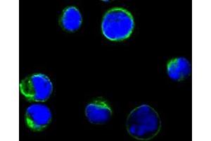 Confocal immunofluorescence analysis of BCBL-1 cells using CD80 antibody (green), showing membrane localization. (CD80 Antikörper)
