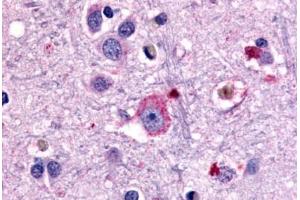 Anti-GRM1 / MGLUR1 antibody  ABIN1048925 IHC staining of human brain, neurons and glia.