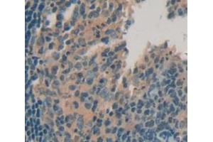 Immunohistochemistry (IHC) image for anti-Tumor Necrosis Factor (Ligand) Superfamily, Member 13 (TNFSF13) (AA 105-250) antibody (ABIN1078630)