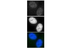 Immunofluorescence (IF) image for anti-DNA Repair Protein Homolog 1 (RAD51) antibody (ABIN2452093) (RAD51 Antikörper)