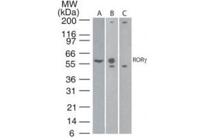 Image no. 1 for anti-RAR-Related Orphan Receptor C (RORC) (AA 1-50) antibody (ABIN959913) (RORC Antikörper  (AA 1-50))